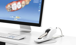 cerec